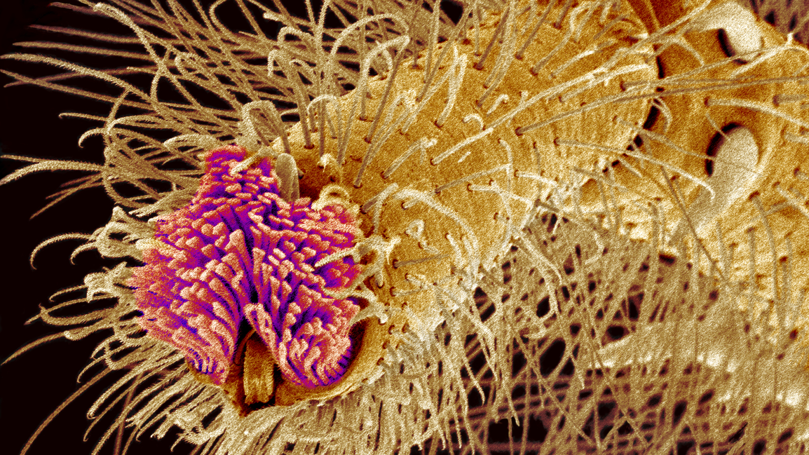 Imagen microscópica de la planta del pie de una tarántula, densamente repleta de pelos conocidos como setas.